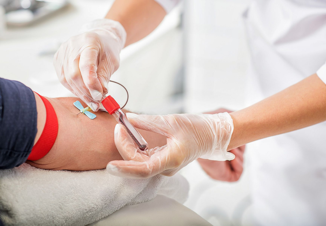 10 Widely Used Laboratory Blood Testing for Older Adults