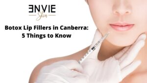 lip filler in Canberra