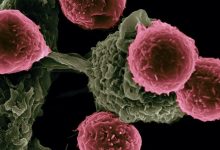 Photo of All you have to know about cancer | Types of cancer